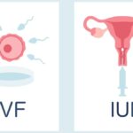IVF VS. IUI