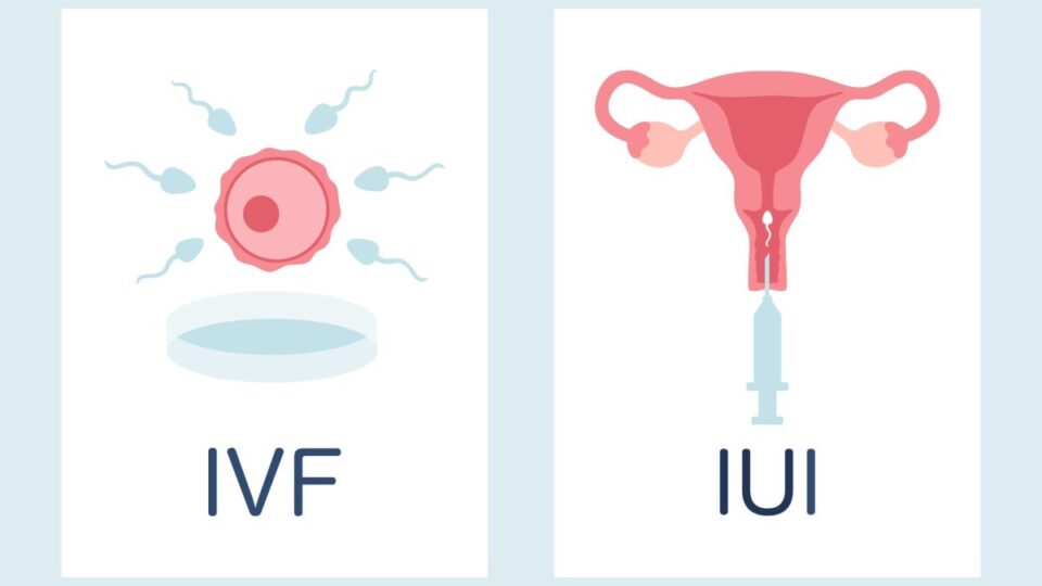 IVF VS. IUI